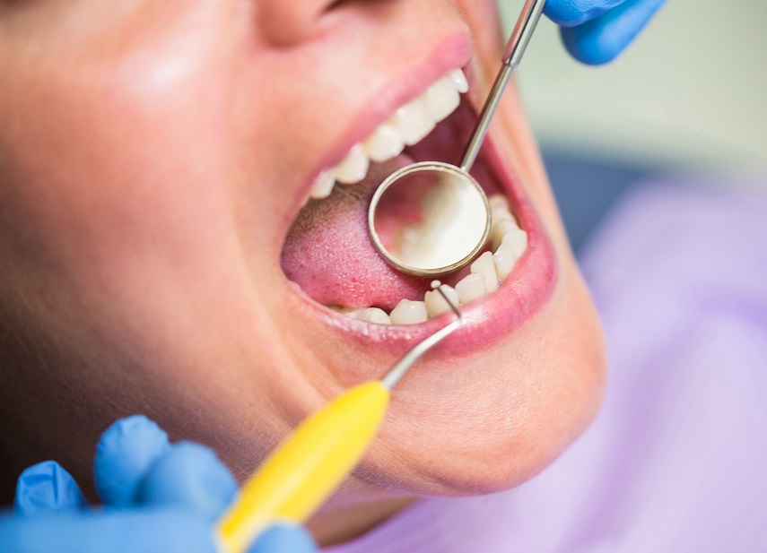 Enfermedad periodontal: síntomas y tratamiento en Quito y Cumbayá