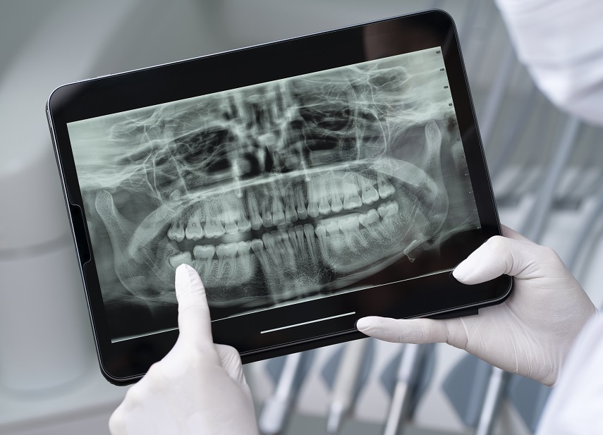 Radiografía dental digital cuándo es necesaria y qué detecta en tu boca Quito